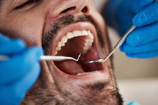 Best Cracked Tooth Emergency Dentist  in Horizon West, FL